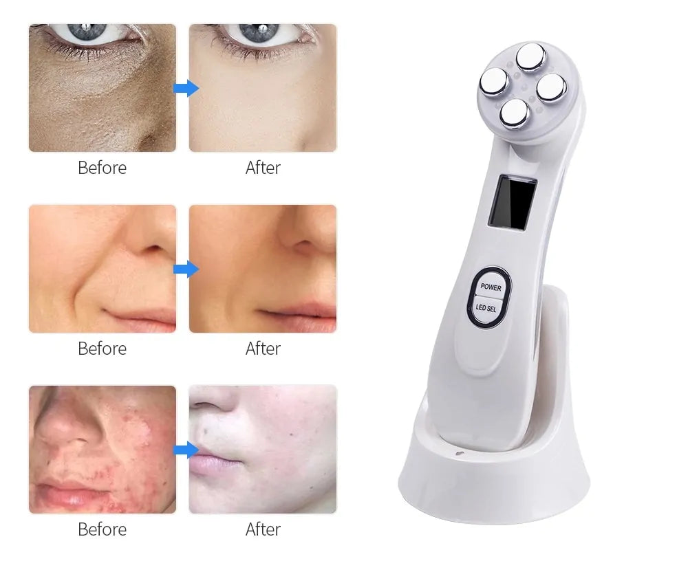 Facial Rejuvenation Massager