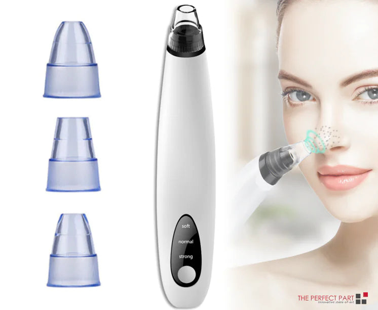 DiamondGlow Blackhead Remover Vacuum